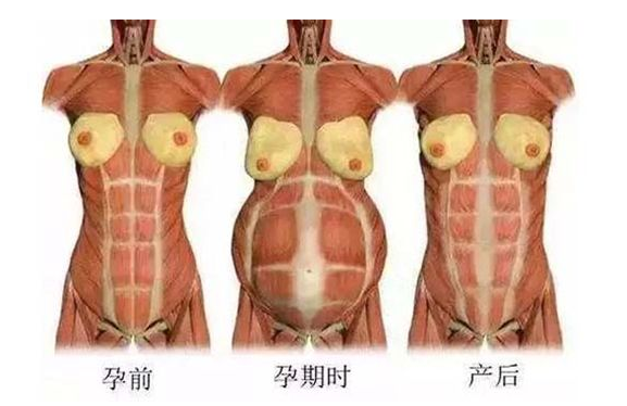 產(chǎn)后媽媽骨盆修復(fù)――帶你回到完美身材！