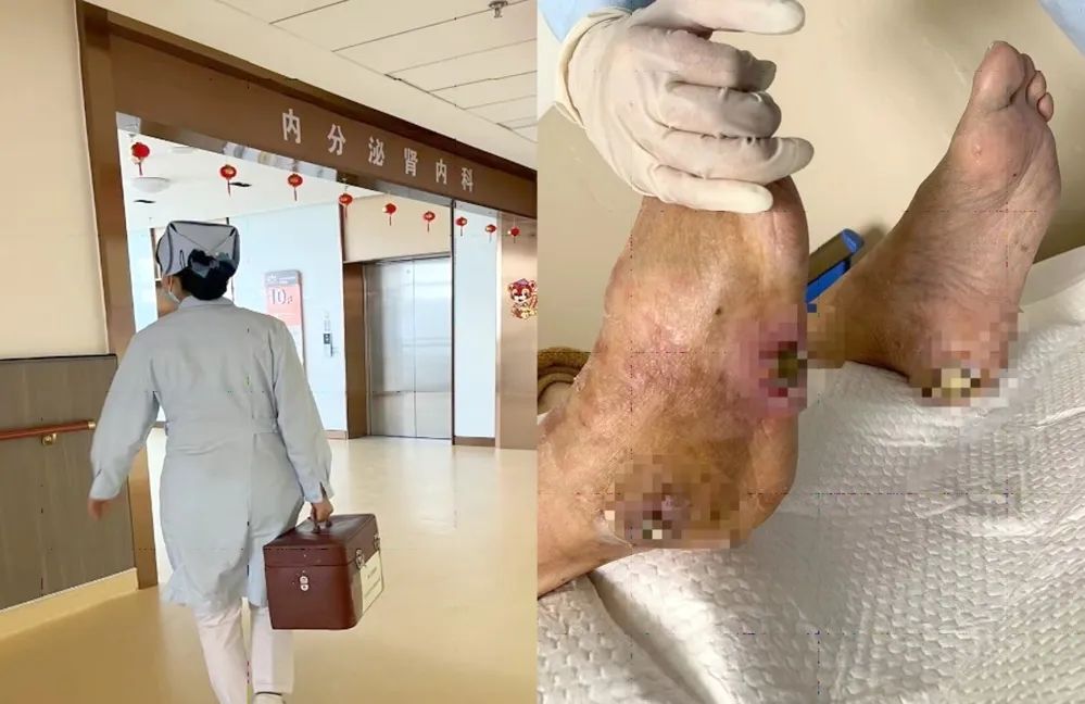 【保山安利醫(yī)院】傷口治療一站式，健康生活零距離！